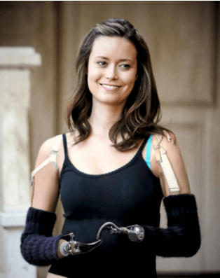 woman with motor impairment